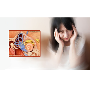 Tăng mức độ của bệnh Meniere